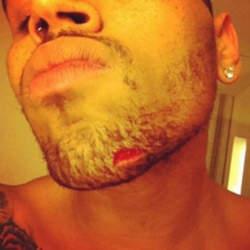 Chris Brown et Drake se sont battus à coups de bouteilles