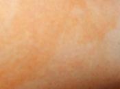 Effacer l'effet vache autobronzants