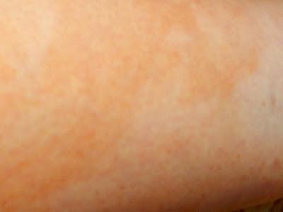 EFFACER L'EFFET VACHE DES AUTOBRONZANTS