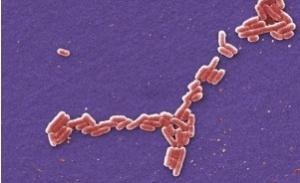 BACTÉRIES: Le biofilm menace aussi à la cuisine – The Atlantic