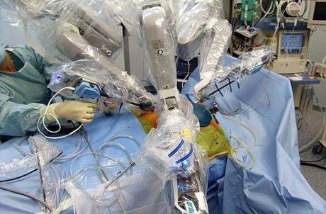 Le robot Da Vinci SHDI a participé à sa 1ère opération de transplantation de foie