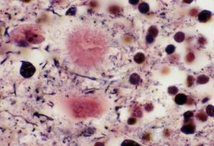 VACHE FOLLE: Découverte d’une nouvelle voie d’infection via la moelle épinière  – American Journal of Pathology