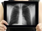 Etats-Unis, carnets santé électroniques passent dans cloud