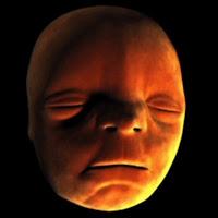 Reconstitution de la formation du visage de l’embryon