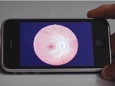 L'iPhone pourrait servir aux diagnostics oculaires...