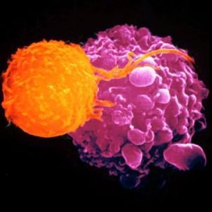 Le Ganoderma et son combat contre le cancer du colon
