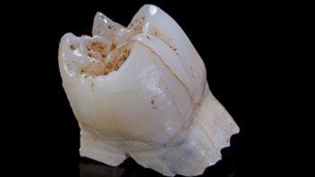 Première molaire supérieure droite d'un <i>Homo</i>. 