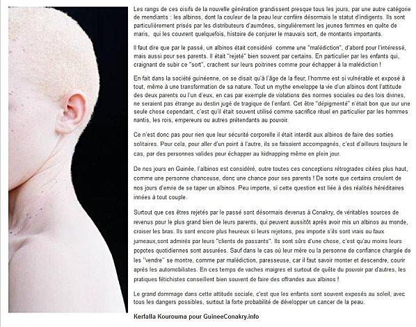 article-albinos.jpg