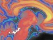 PUISSANCE, question cortex plus force musculaire Cortex cérébral