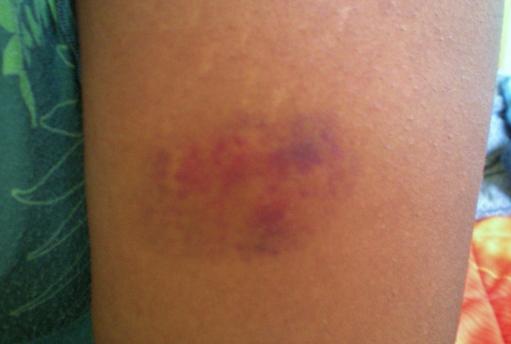 Non, je ne mets pas les dents. Et toi ?