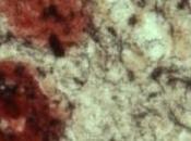 ALZHEIMER: L’enzyme frappe toujours deux fois Journal Neuroscience