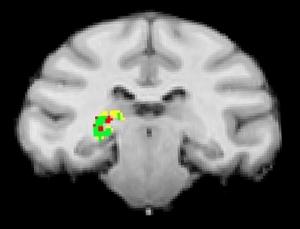 NEURO: La petite zone du cerveau qui fait le tri pour notre survie – Science