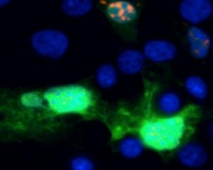 X FRAGILE: La petite molécule qui pourrait supprimer les tremblements  – ACS Chemical Biology
