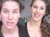 Cassandra Bankson model acnéique tutoriel époustouflant