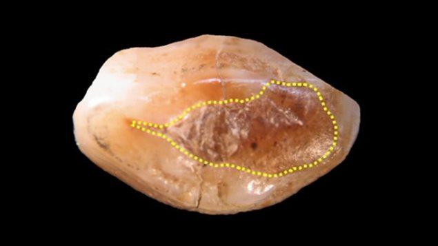 Dentiste préhistorique