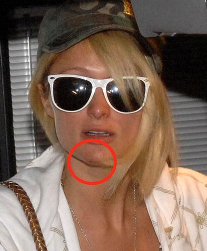 P’tites vites: “Mon visage! Mon beau visage!”