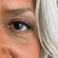 Cataracte: quels sont les premiers signes?