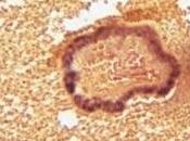 ACNÉ: virus bactériophage pour traiter? MBio