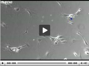 PARKINSON, ALZHEIMER : Des neurones tout neufs à partir d’autres cellules du cerveau – Cell Stem Cell