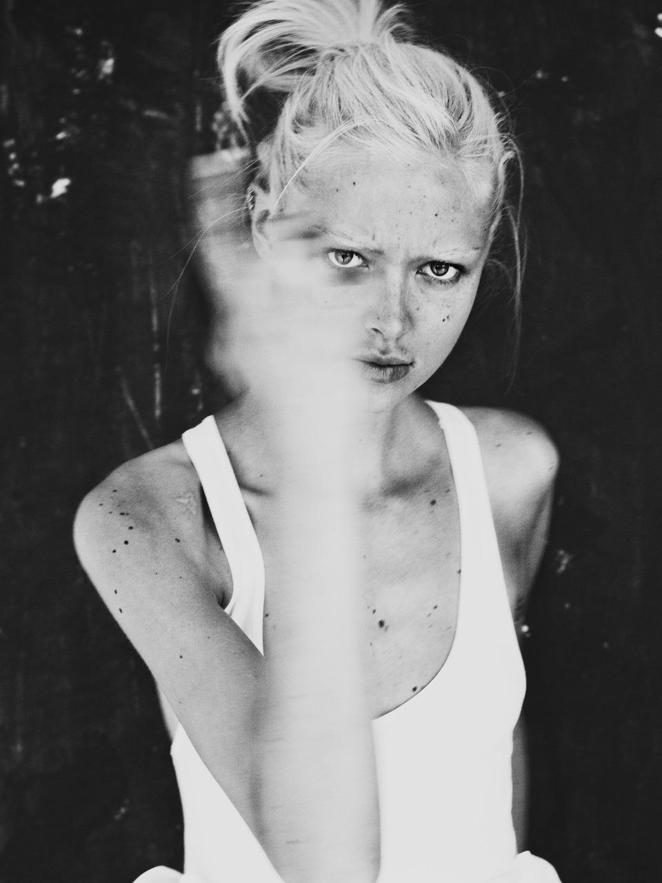 I was shot by Billy Kidd