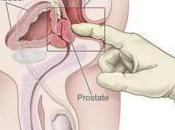 cancer prostate: risque majeur pour plus