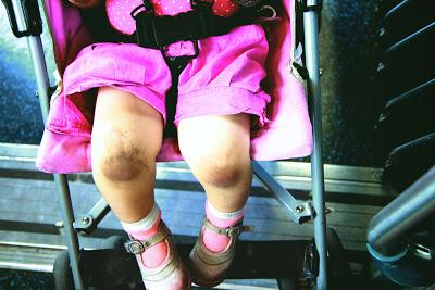 genoux salis mais textile moelleux