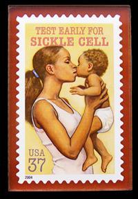 « Breack the Sicle Circle » le beau slogan de la SCDAA contre la Drépano !