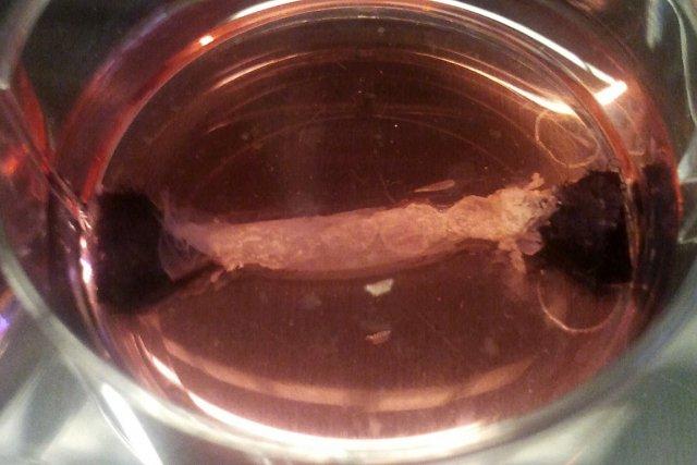 Des bandelettes de cellules musculaires.... (Photo: fournie par l'Université de Maastricht)