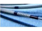 VARICES: radiofréquence, l’autre solution CHRU Brest, Réseau