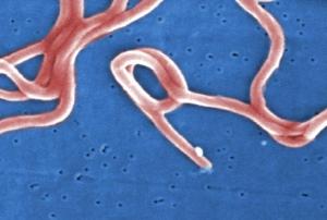 Maladie de LYME: A la recherche des gènes bactériens responsables de la virulence  – PLoS ONE