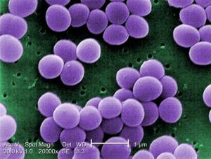 INFECTIONS NOSOCOMIALES: Identification d’un gène qui donne au SARM sa résistance – CNRS- PLoS Pathogens