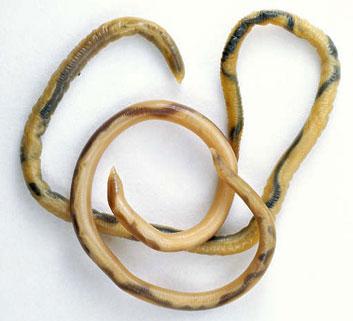 Les tendances santé les plus bizarres au monde