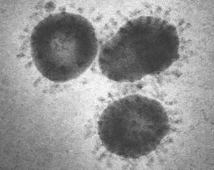 SRAS: Le nouveau coronavirus nous vient des chauves-souris asiatiques – MBio