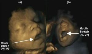 DÉVELOPPEMENT: Le bâillement du fœtus dans l’utérus, indicateur de santé du bébé – PLoS ONE