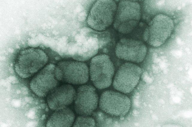 Le virus de la variole.... (Photo archives AP)