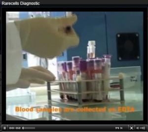 DIAGNOSTIC ANTÉNATAL: Une simple prise de sang pour détecter les maladies génétiques – Reproductive Biomedicine
