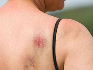 11 REMÈDES DE GRAND-MÈRE À ÉVITER