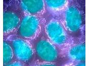 CANCER PROSTATE: virus caché dans macrophage pour tuer tumeur Cancer Research