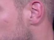 Star Academy Jimmy éliminé