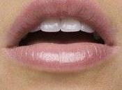 Perlèche: infection coin lèvres