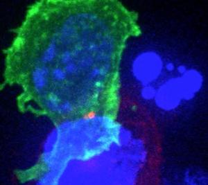 CANCER, VIH: Booster le système immunitaire via des cellules souches tueuses – Cell Stem Cell