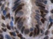 FERTILITÉ: fausses couches associées fenêtre fécondité prolongée PLoS
