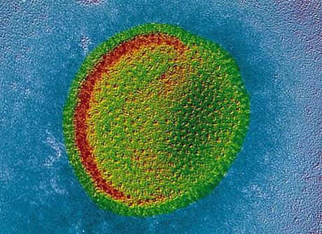 1007444 Virus de la grippe Épidémie de grippe: le maire de Boston déclare lEtat durgence