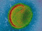 Épidémie grippe: maire Boston déclare l’Etat d’urgence