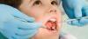 Mercure dentaire : un produit toxique dans la bouche des Français
