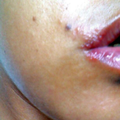 Je me suis réveillée avec ca sur la bouche ce matin, vous avez une idée de ce que c’est ? Désolée c’est pas très joli à voir… décidément cette fin de voyage….
