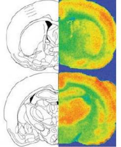 Les TRAUMATISMES à L’ENFANCE, laissent des marques à vie au cerveau – Translational Psychiatry