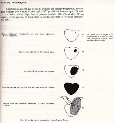 Administration de docetaxel 1 fois en 2 semaines versus 1 fois en 3 semaines dans le traitement d’un cancer de la prostate à un stade avancé résistant à la castration : un essai randomisé de phase 3