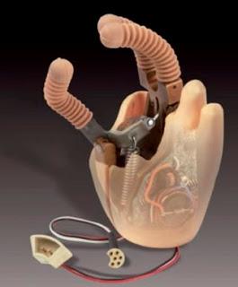 Contrôle neuro-prosthétique de haute performance chez un sujet tétraplégique