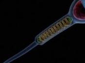 FERTILITÉ: Baisse qualité sperme (Sud L’Espagne) Andrology